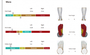 3D foot scanner
