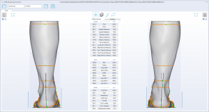 3D foot scanner