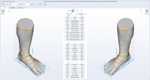 3D foot scanner