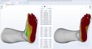 3D foot scanner