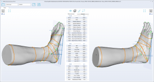 3D foot scanner