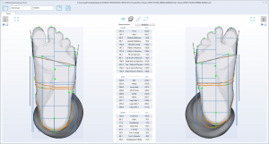 3D foot scanner