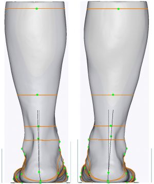 3D foot scanner