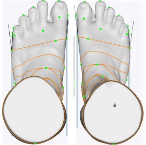 3D foot scanner