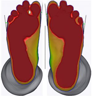 3D foot scanner